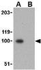 NPHS1 Adhesion Molecule, Nephrin antibody, GTX31654, GeneTex, Western Blot image 