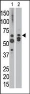 MTM1 antibody, AP13513PU-N, Origene, Western Blot image 