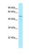 Syntrophin Beta 2 antibody, orb326451, Biorbyt, Western Blot image 