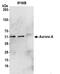 Aurora Kinase A antibody, 13040, QED Bioscience, Western Blot image 