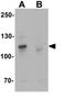 Teashirt Zinc Finger Homeobox 3 antibody, GTX31474, GeneTex, Western Blot image 