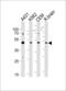 Histone-lysine N-methyltransferase SUV39H2 antibody, MBS9209152, MyBioSource, Western Blot image 