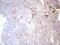 c-Kit antibody, LS-C798597, Lifespan Biosciences, Immunohistochemistry paraffin image 