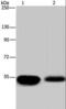 Amyloid beta A4 precursor protein-binding family A member 1 antibody, LS-C406129, Lifespan Biosciences, Western Blot image 