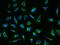 Pyruvate Dehydrogenase E1 Alpha 1 Subunit antibody, 14567-R006, Sino Biological, Immunohistochemistry paraffin image 