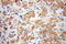 RCC1 Like antibody, 13796-1-AP, Proteintech Group, Immunohistochemistry paraffin image 