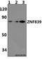 Zinc Finger Protein 839 antibody, GTX66807, GeneTex, Western Blot image 