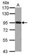 Plasminogen antibody, GTX102877, GeneTex, Western Blot image 