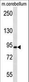 Amyloid Beta Precursor Protein Binding Family A Member 2 antibody, LS-C156395, Lifespan Biosciences, Western Blot image 