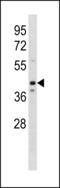 Olfactomedin 3 antibody, LS-C203879, Lifespan Biosciences, Western Blot image 