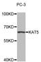 Lysine Acetyltransferase 5 antibody, STJ24280, St John