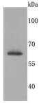 Succinate Dehydrogenase Complex Flavoprotein Subunit A antibody, A01753-1, Boster Biological Technology, Western Blot image 