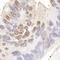 RecQ Mediated Genome Instability 1 antibody, NB100-1720, Novus Biologicals, Immunohistochemistry frozen image 