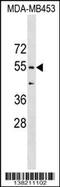 Coronin 1B antibody, 59-553, ProSci, Western Blot image 
