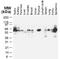 TNF receptor-associated factor 2 antibody, NB100-56173, Novus Biologicals, Western Blot image 