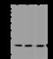 Transmembrane Protein 199 antibody, 201047-T36, Sino Biological, Western Blot image 