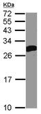 Deoxycytidine Kinase antibody, ab96599, Abcam, Western Blot image 