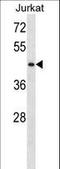 Serine/Threonine Kinase 33 antibody, LS-C161563, Lifespan Biosciences, Western Blot image 