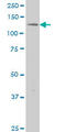 Endoplasmic Reticulum To Nucleus Signaling 1 antibody, LS-B5404, Lifespan Biosciences, Western Blot image 