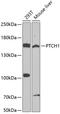 PTCH1 antibody, 13-291, ProSci, Western Blot image 