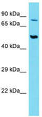 Choline transporter-like protein 2 antibody, TA333738, Origene, Western Blot image 