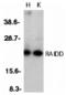 CASP2 And RIPK1 Domain Containing Adaptor With Death Domain antibody, A06509-1, Boster Biological Technology, Western Blot image 