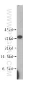 Histamine N-Methyltransferase antibody, 11874-1-AP, Proteintech Group, Western Blot image 