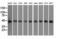 Death Associated Protein Kinase 2 antibody, M02241, Boster Biological Technology, Western Blot image 
