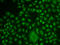 TCF3 Fusion Partner antibody, A10760, Boster Biological Technology, Western Blot image 