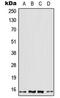 Profilin 2 antibody, LS-B13581, Lifespan Biosciences, Western Blot image 