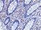 CD82 Molecule antibody, PA5-20356, Invitrogen Antibodies, Immunohistochemistry frozen image 
