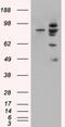 E3 ubiquitin-protein ligase Mdm2 antibody, 45-878, ProSci, Enzyme Linked Immunosorbent Assay image 