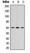 LYN Proto-Oncogene, Src Family Tyrosine Kinase antibody, LS-C368402, Lifespan Biosciences, Western Blot image 