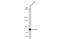 Angiotensin I Converting Enzyme 2 antibody, GTX135406, GeneTex, Western Blot image 