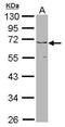 Jumonji Domain Containing 6, Arginine Demethylase And Lysine Hydroxylase antibody, PA5-22132, Invitrogen Antibodies, Western Blot image 