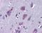 Tripartite Motif Containing 2 antibody, orb94244, Biorbyt, Immunohistochemistry paraffin image 