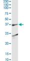 SH3 Domain Containing GRB2 Like 1, Endophilin A2 antibody, H00006455-M05, Novus Biologicals, Immunocytochemistry image 