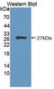 Homeodomain Interacting Protein Kinase 2 antibody, LS-C688563, Lifespan Biosciences, Western Blot image 