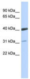 Visual system homeobox 1 antibody, TA343742, Origene, Western Blot image 