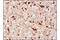 Superoxide Dismutase 2 antibody, 13141P, Cell Signaling Technology, Immunohistochemistry paraffin image 