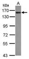 A-Kinase Anchoring Protein 1 antibody, PA5-30266, Invitrogen Antibodies, Western Blot image 