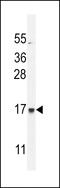 Cilia And Flagella Associated Protein 410 antibody, 55-415, ProSci, Western Blot image 