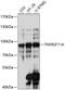 TNF Receptor Superfamily Member 11a antibody, 14-961, ProSci, Western Blot image 