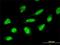 Zinc Finger Protein 396 antibody, H00252884-M01, Novus Biologicals, Immunocytochemistry image 
