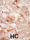 Pre-MRNA Processing Factor 4B antibody, abx033469, Abbexa, Immunohistochemistry paraffin image 