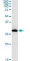 Carbonic Anhydrase 1 antibody, H00000759-D01P, Novus Biologicals, Western Blot image 