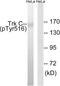 Neurotrophic Receptor Tyrosine Kinase 3 antibody, LS-C199689, Lifespan Biosciences, Western Blot image 