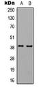 G Protein Subunit Alpha L antibody, LS-C358758, Lifespan Biosciences, Western Blot image 