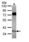 Protein Phosphatase 6 Catalytic Subunit antibody, PA5-28919, Invitrogen Antibodies, Western Blot image 