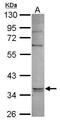 Glycerol-3-phosphate dehydrogenase [NAD+], cytoplasmic antibody, PA5-31051, Invitrogen Antibodies, Western Blot image 